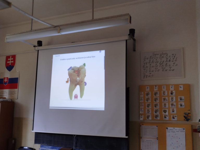 Starostlivosť o zuby – beseda